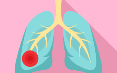 How Does Asbestos Exposure Affect the Lungs?