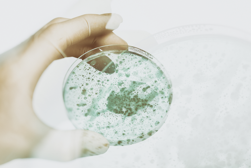 The Importance of Inspecting for Mold at Your Office: Insights from a Mold Removal Contractor in Elk Grove Village, Illinois