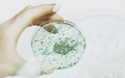 The Importance of Inspecting for Mold at Your Office: Insights from a Mold Removal Contractor in Elk Grove Village, Illinois